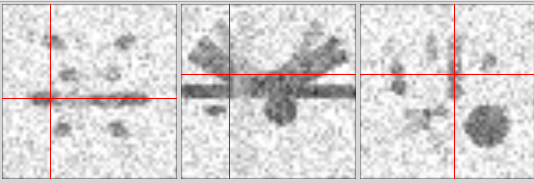 Diffusion weighted images